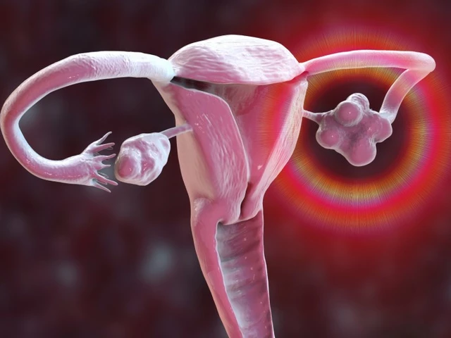 El papel de la Ezetimiba en el manejo del Síndrome de Ovario Poliquístico (SOP)